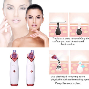 Electric Facial Cleaner Vacuum Suction Set Beauty Skin Care Tools